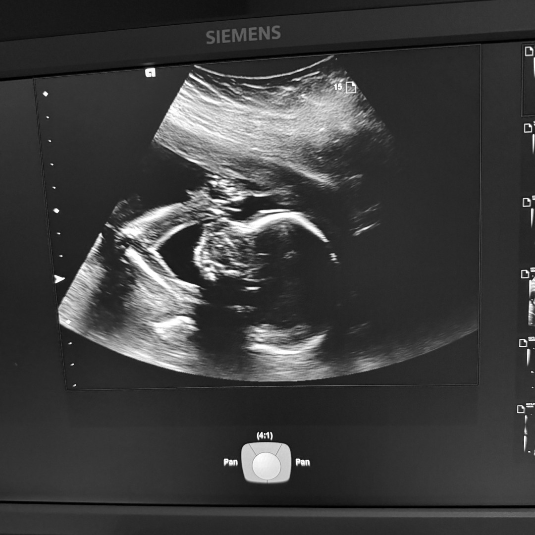 Photo shared by Brooklyn for their Babylist baby registry.