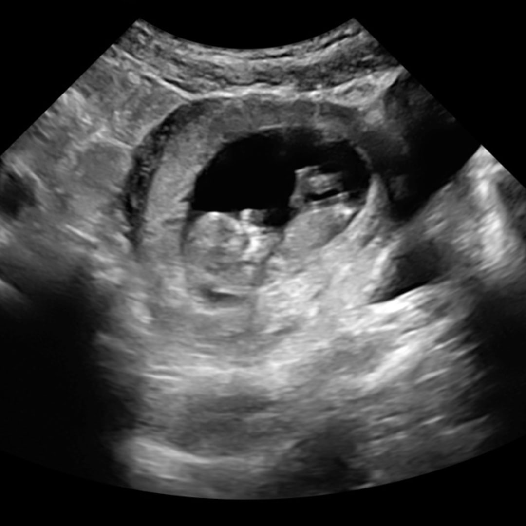 Photo shared by Abigael for their Babylist baby registry.