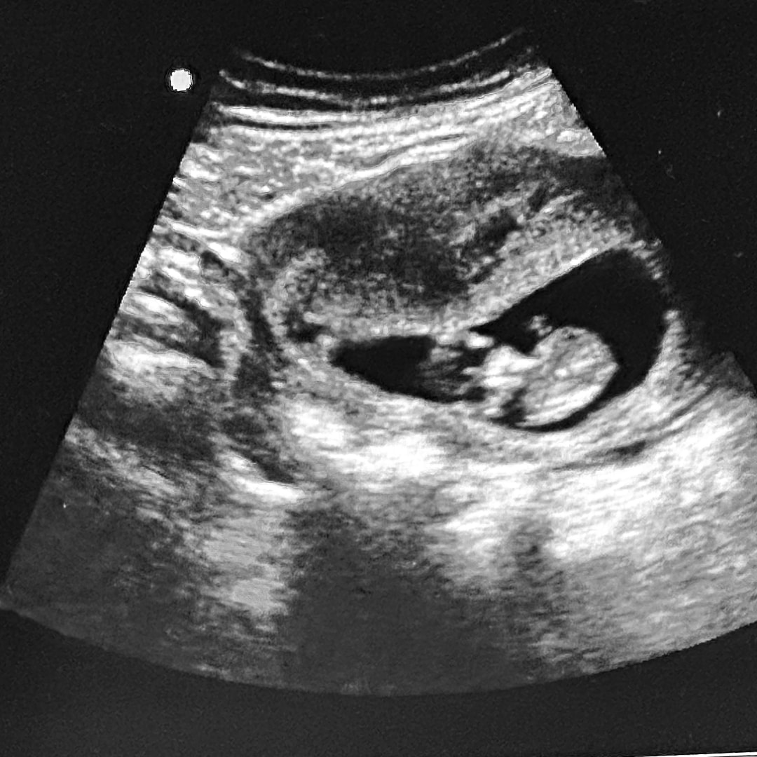 Photo shared by Brielle for their Babylist baby registry.