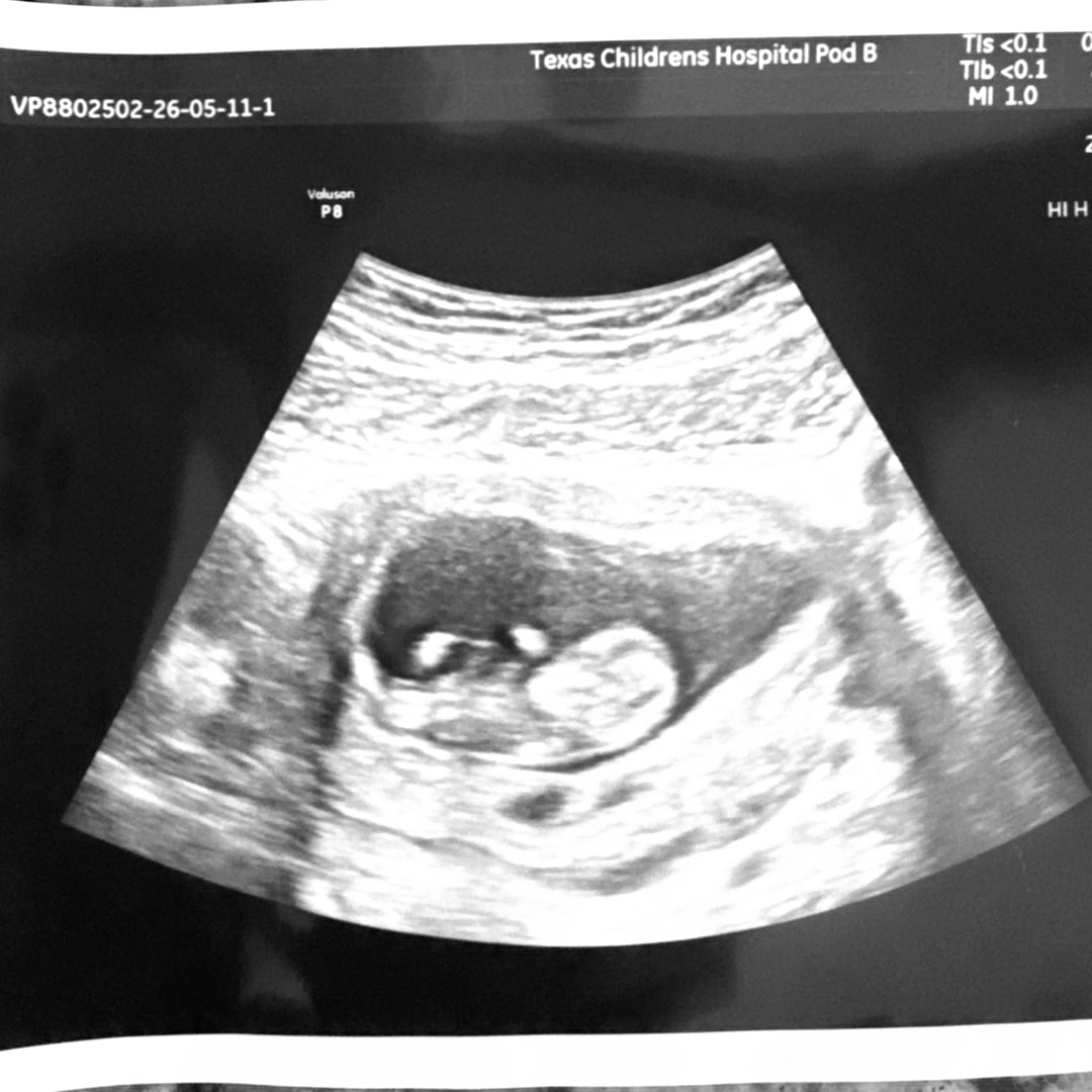 Photo shared by Payton for their Babylist baby registry.