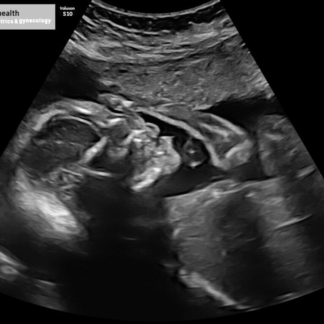 Photo shared by Cheyenne for their Babylist baby registry.