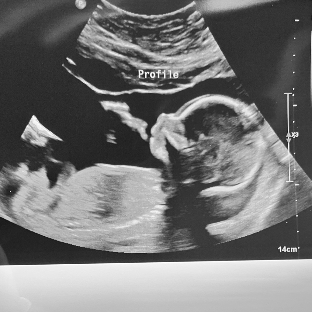 Photo shared by Tiffany for their Babylist baby registry.