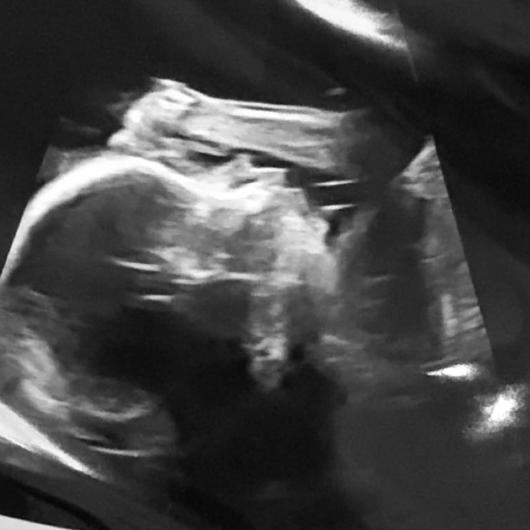 Photo shared by Rubi for their Babylist baby registry.