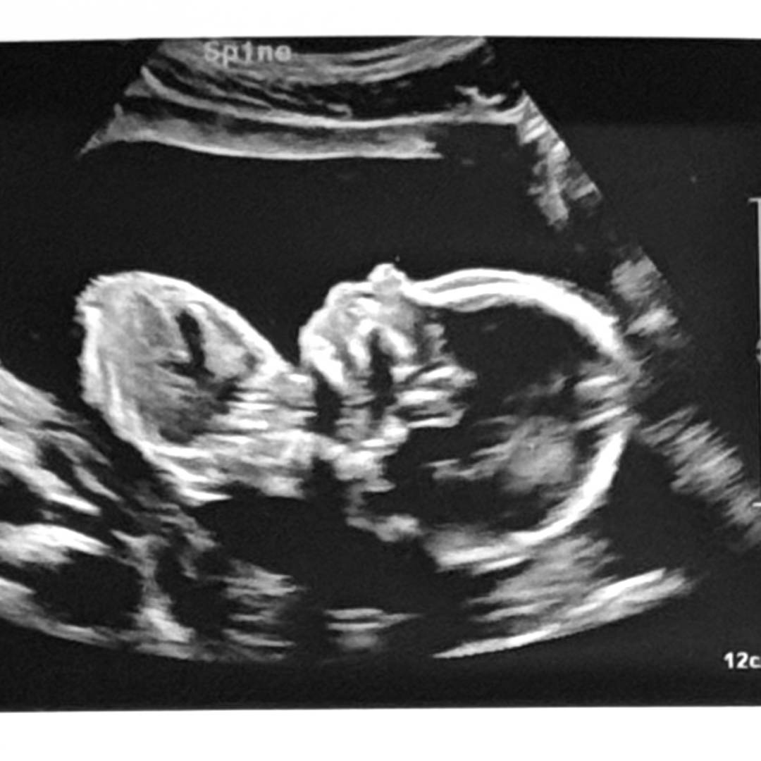 Photo shared by Toni for their Babylist baby registry.