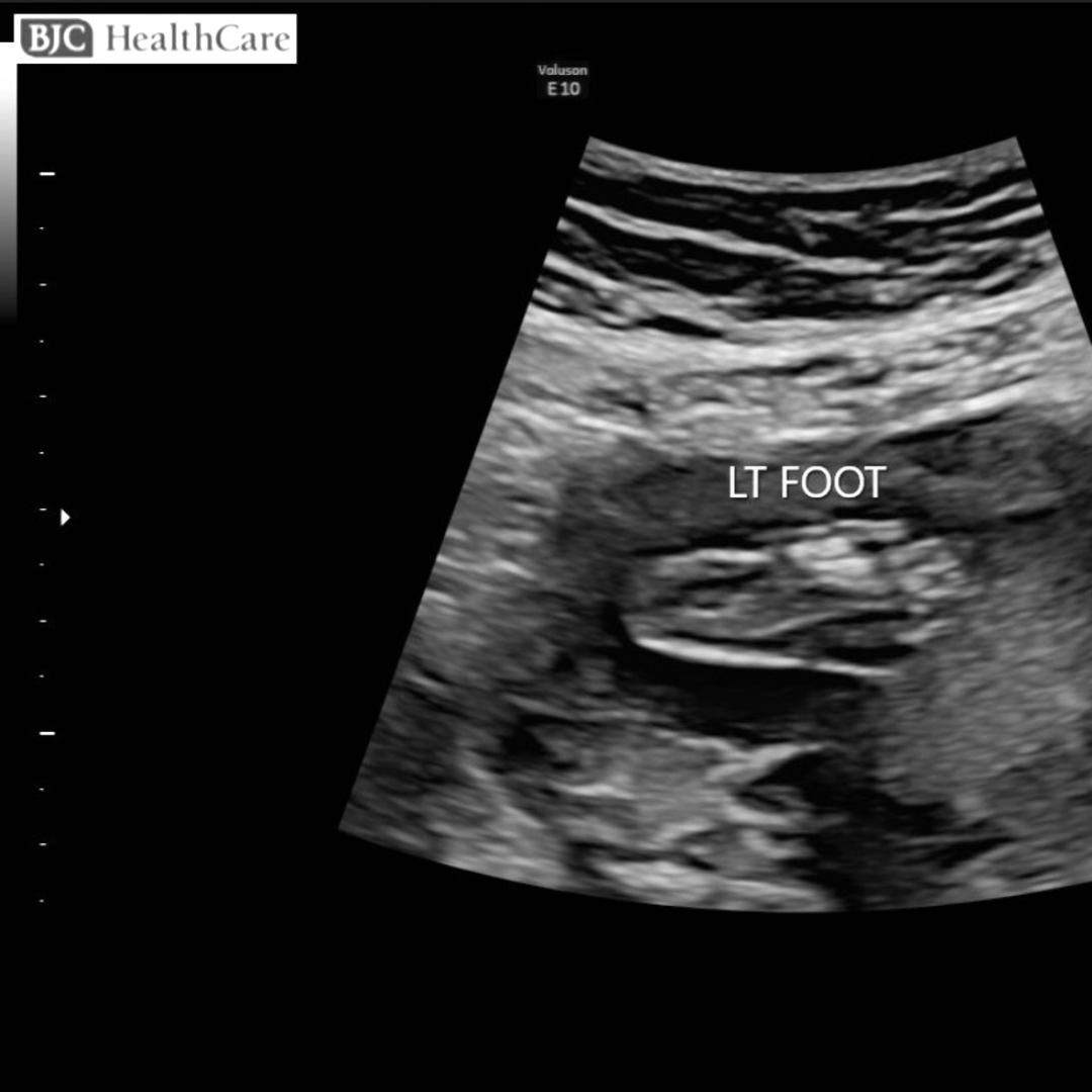 Photo shared by Megan for their Babylist baby registry.