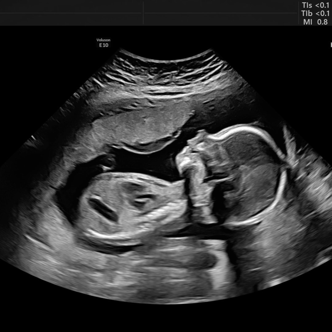 Photo shared by Holly for their Babylist baby registry.