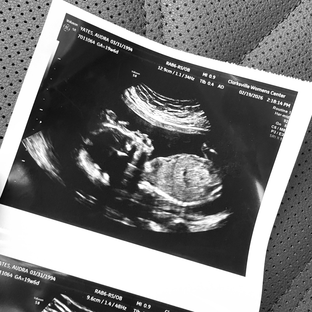 Photo shared by Audra for their Babylist baby registry.