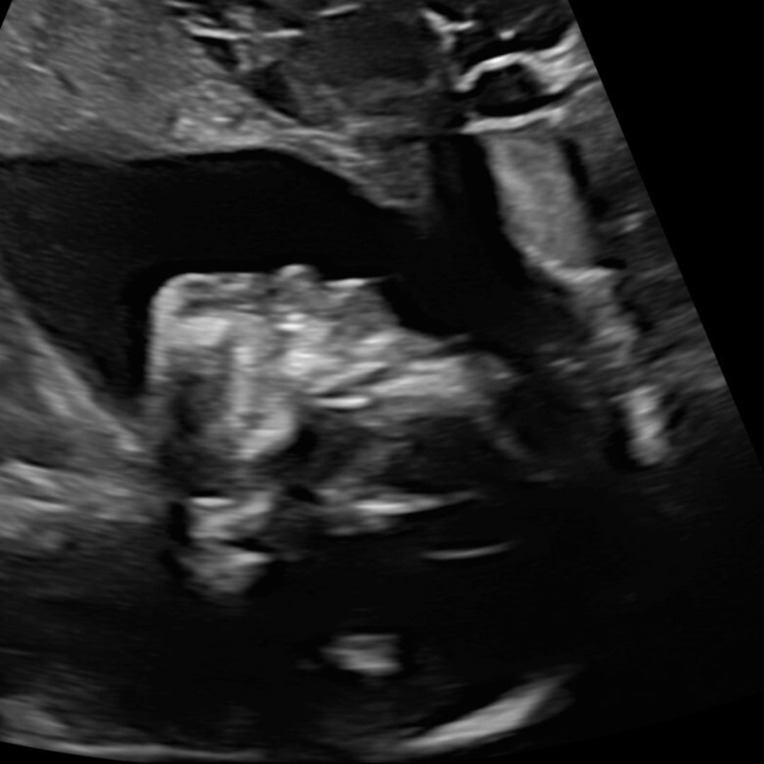 Photo shared by Daesha for their Babylist baby registry.