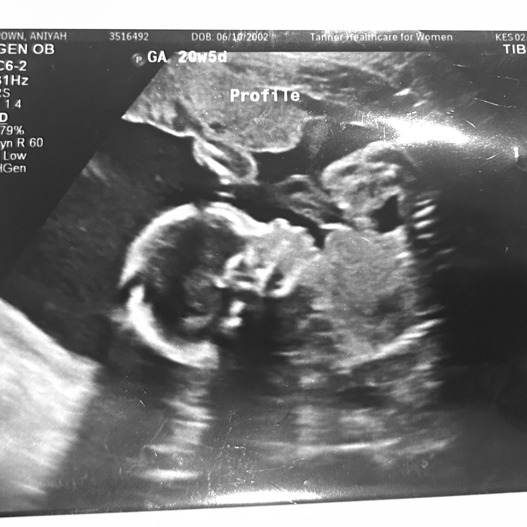 Photo shared by Aniyah for their Babylist baby registry.