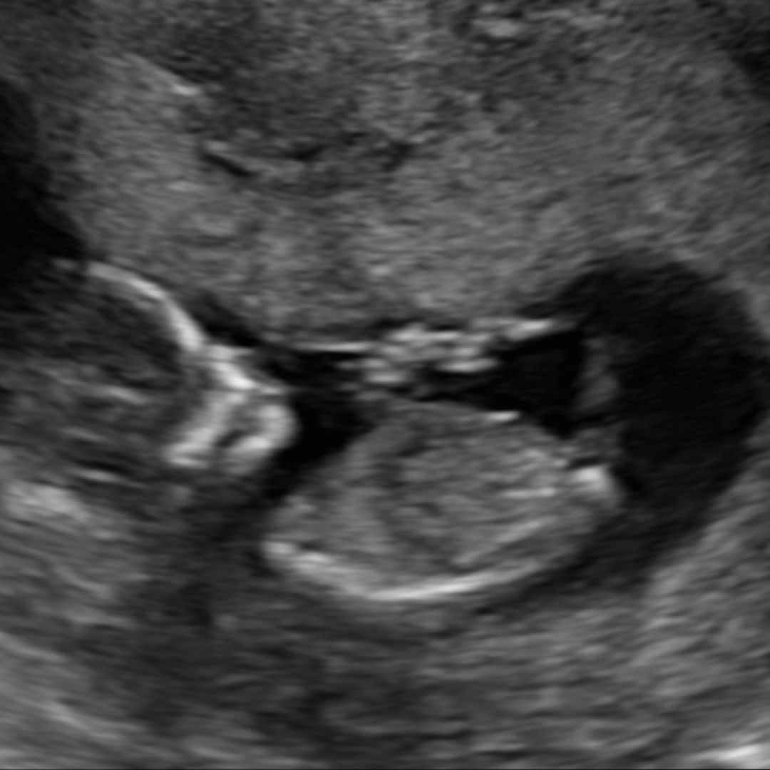 Photo shared by Erica for their Babylist baby registry.