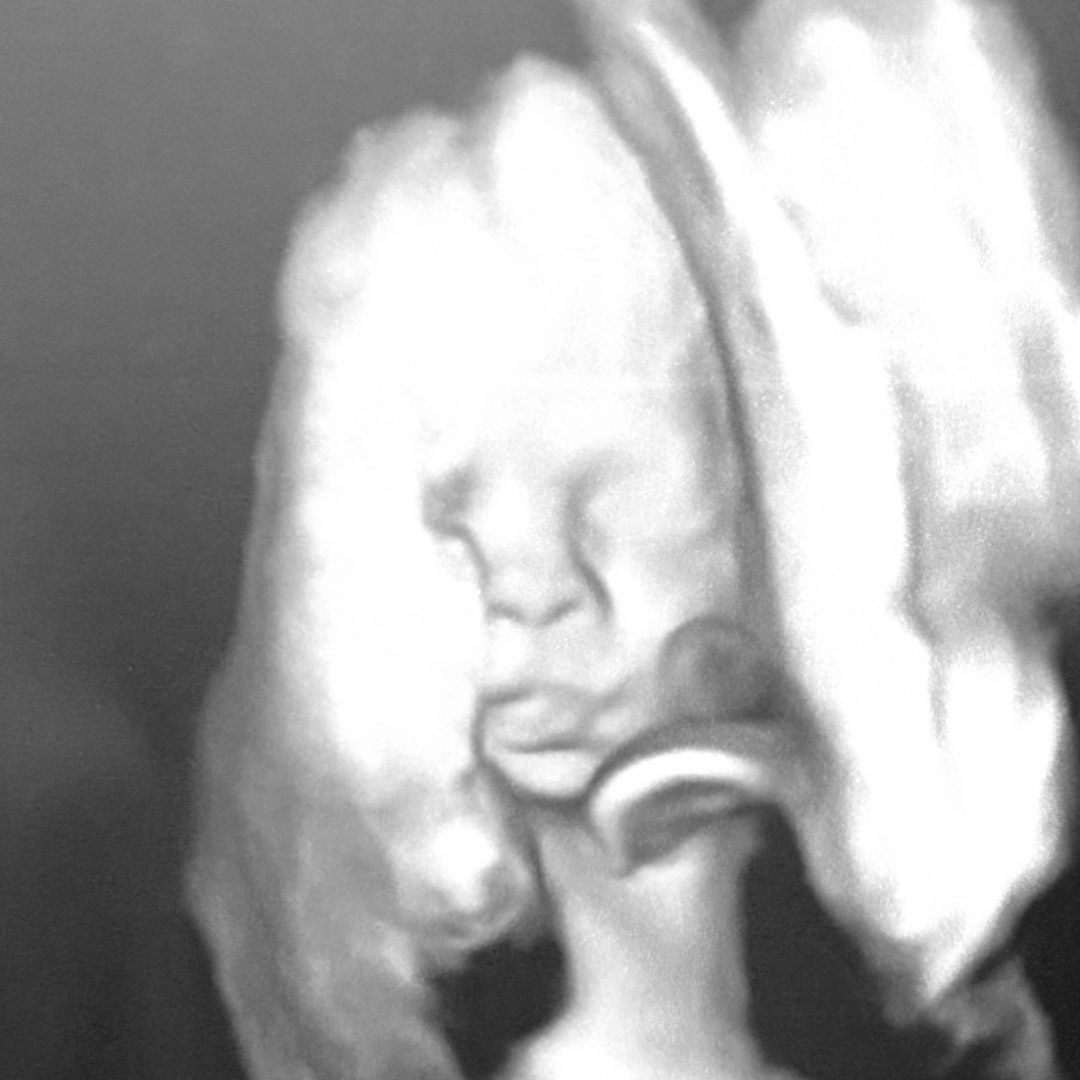 Photo shared by Destiny for their Babylist baby registry.