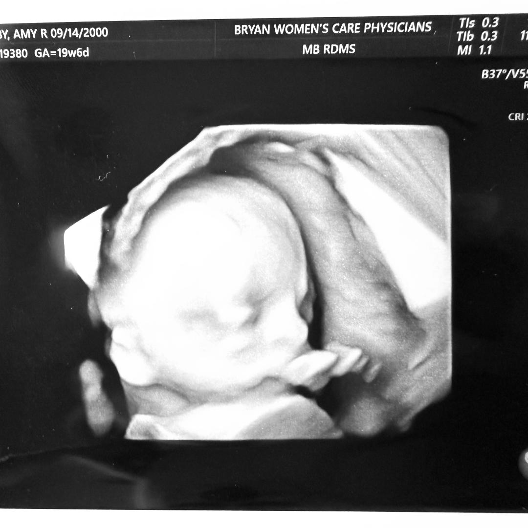 Photo shared by Amy for their Babylist baby registry.