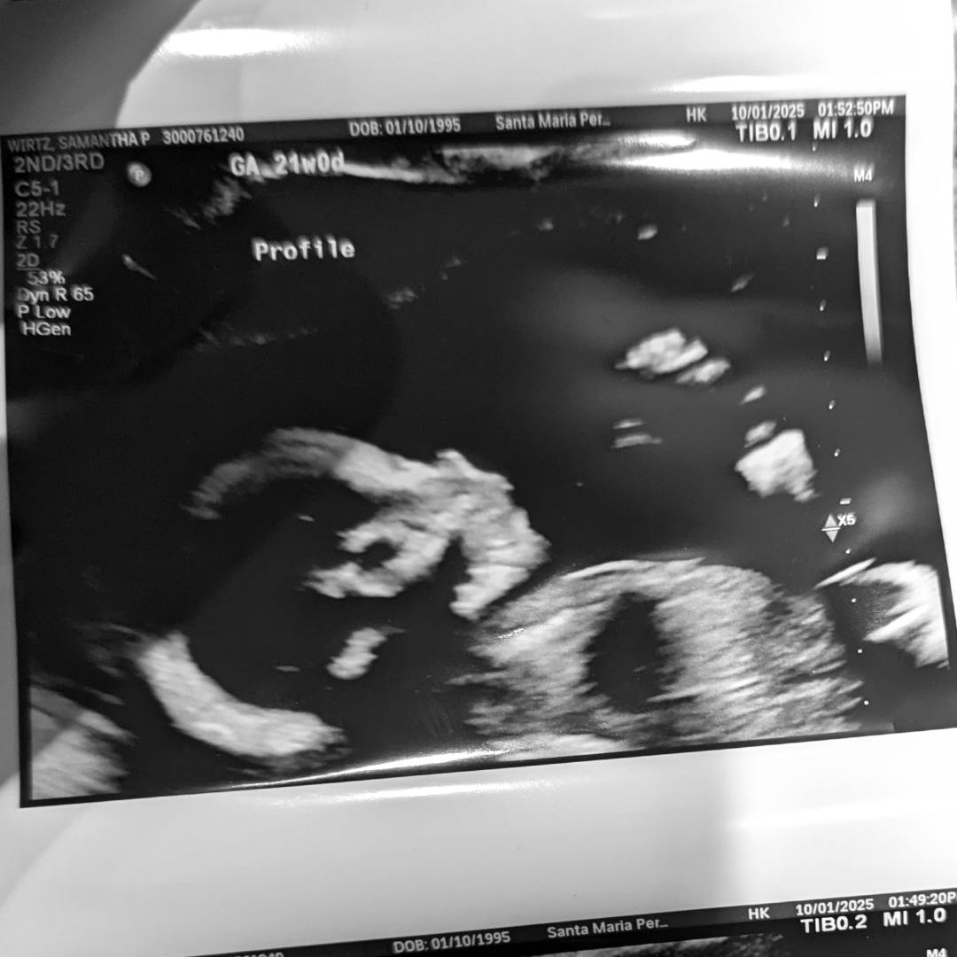 Photo shared by Ryan for their Babylist baby registry.