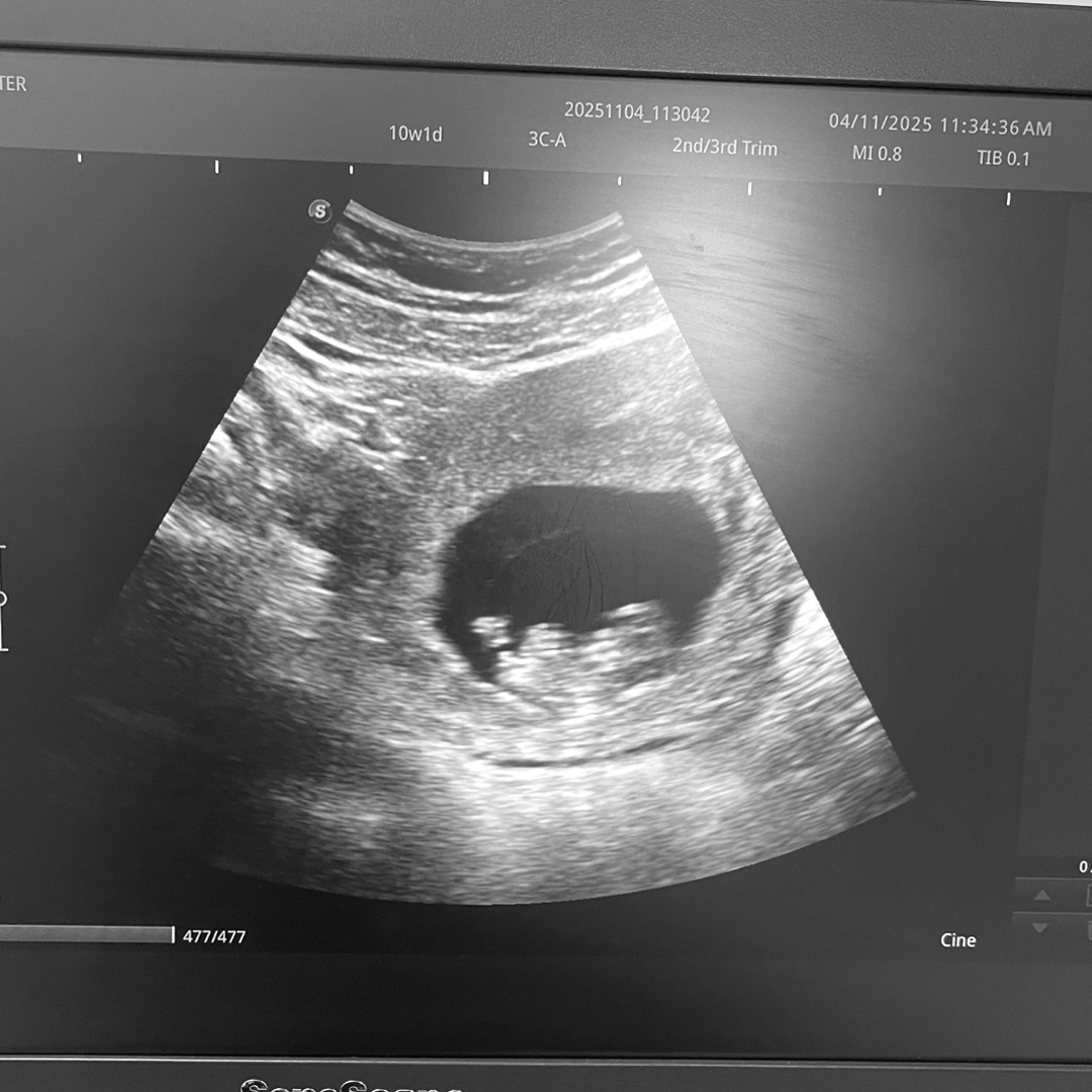 Photo shared by Amaris for their Babylist baby registry.