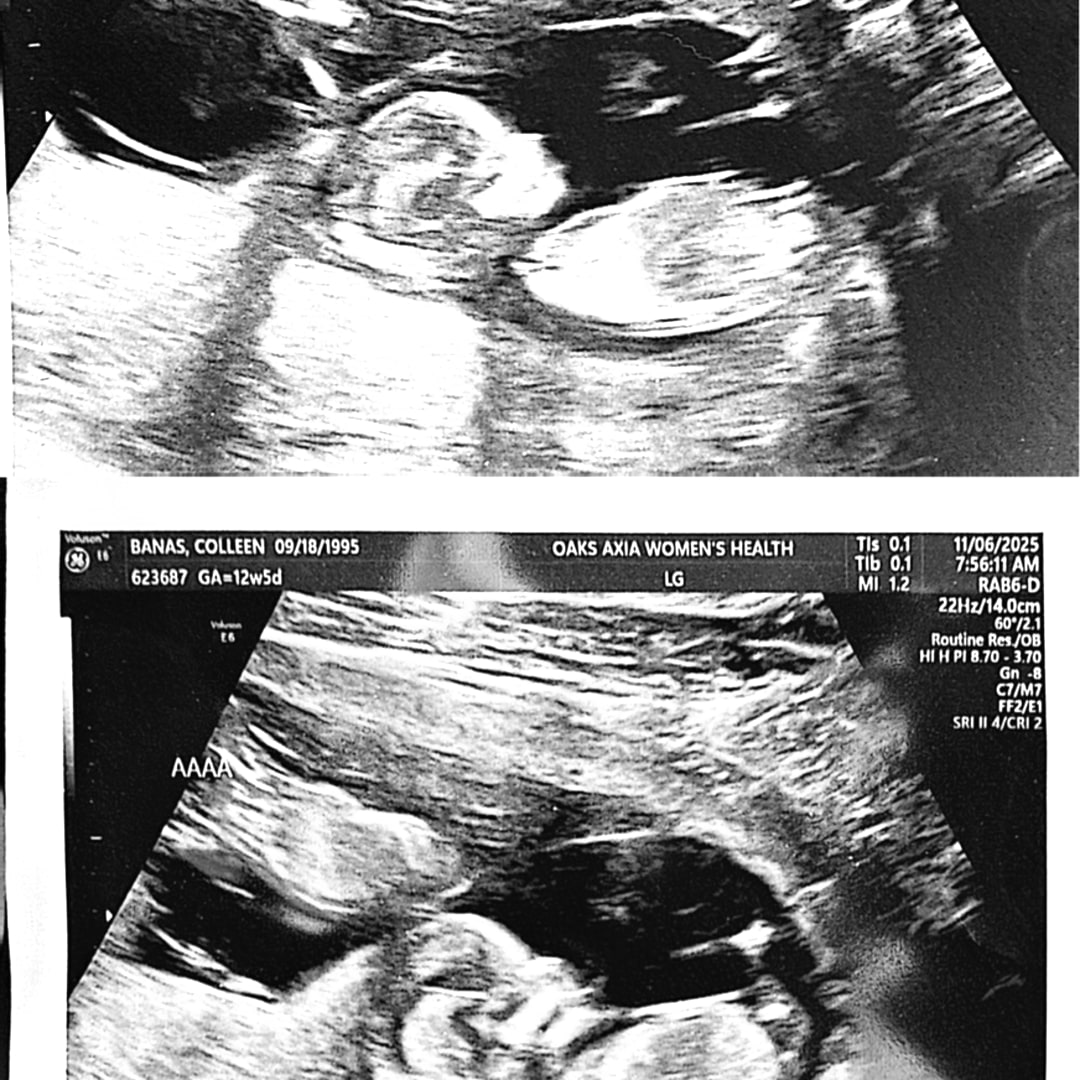 Photo shared by Colleen for their Babylist baby registry.