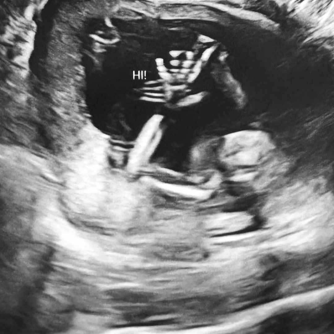 Photo shared by Ashley for their Babylist baby registry.