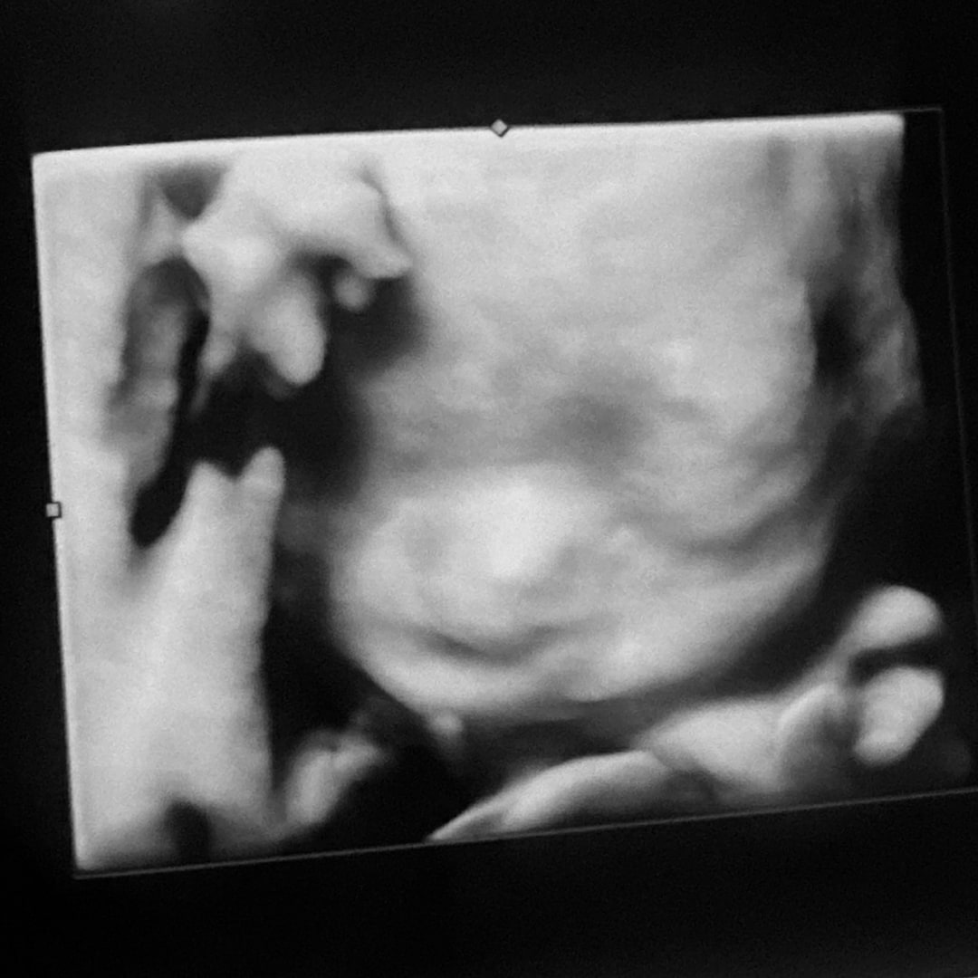 Photo shared by Adamaris for their Babylist baby registry.
