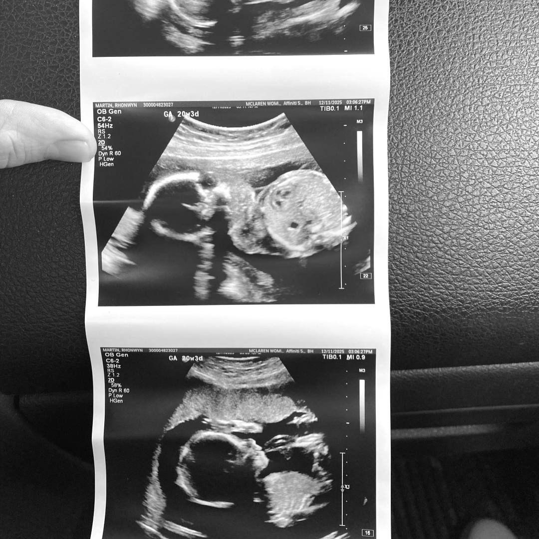 Photo shared by Rhonwyn for their Babylist baby registry.