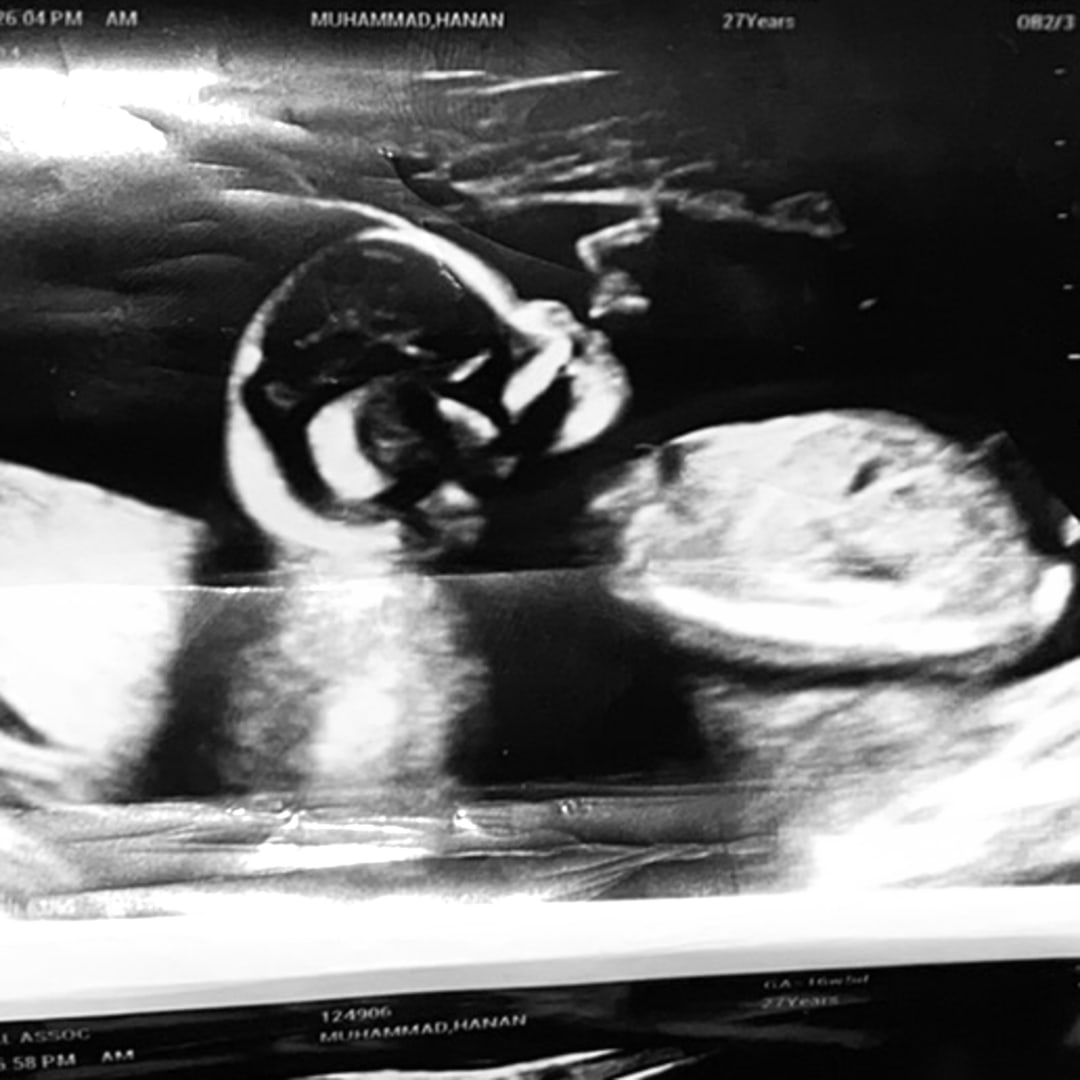 Photo shared by Hanan for their Babylist baby registry.