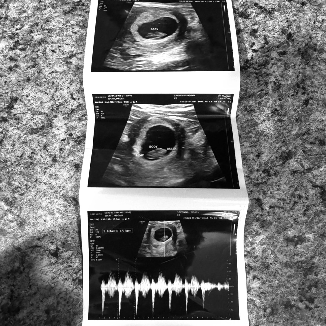 Photo shared by Megan for their Babylist baby registry.