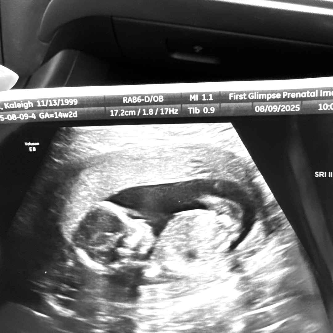 Photo shared by Kaleigh for their Babylist baby registry.