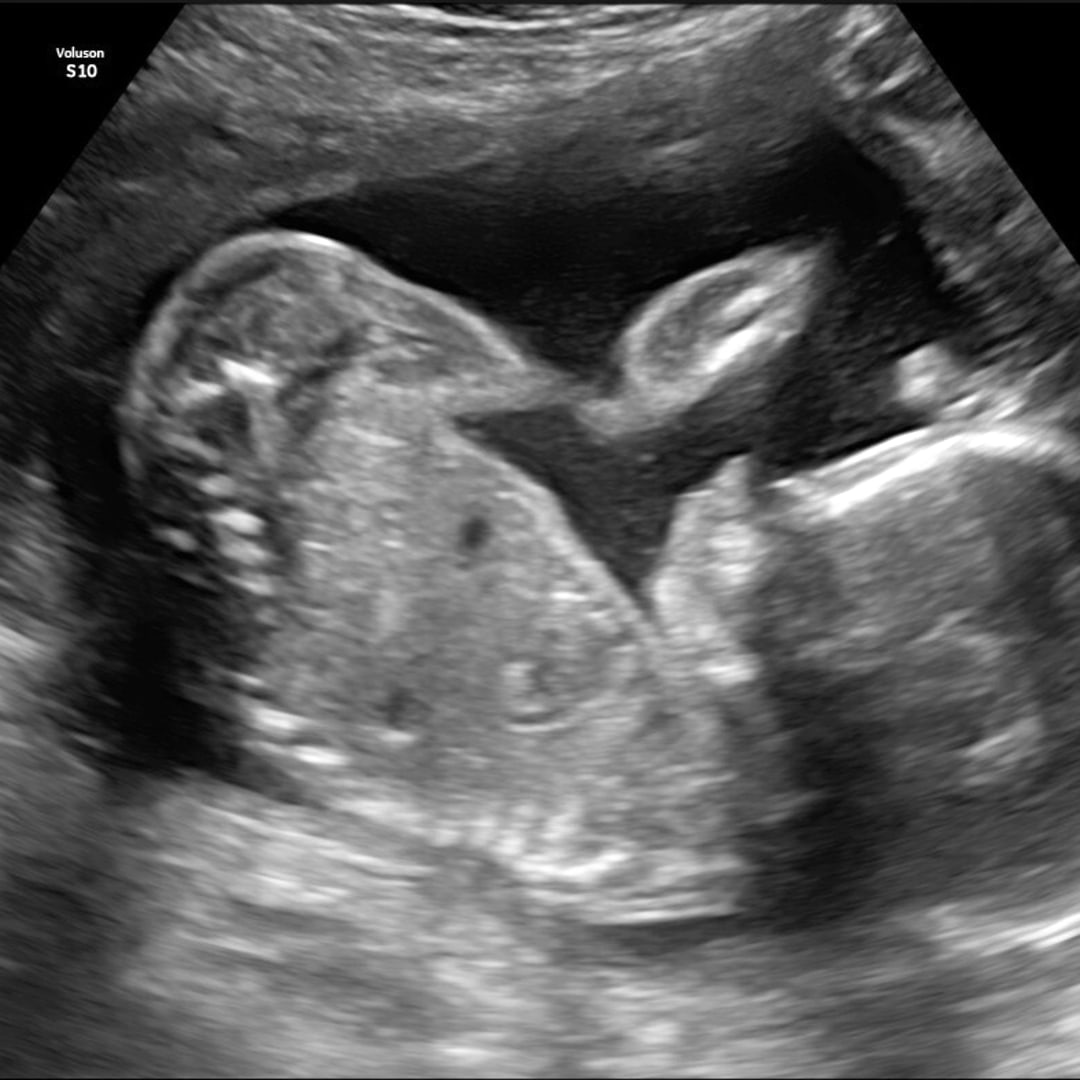 Photo shared by Madison for their Babylist baby registry.