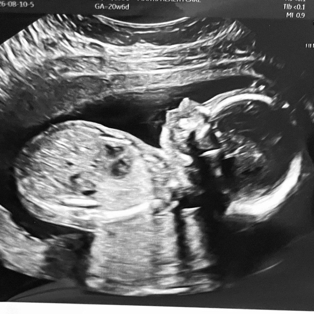 Photo shared by Annie for their Babylist baby registry.