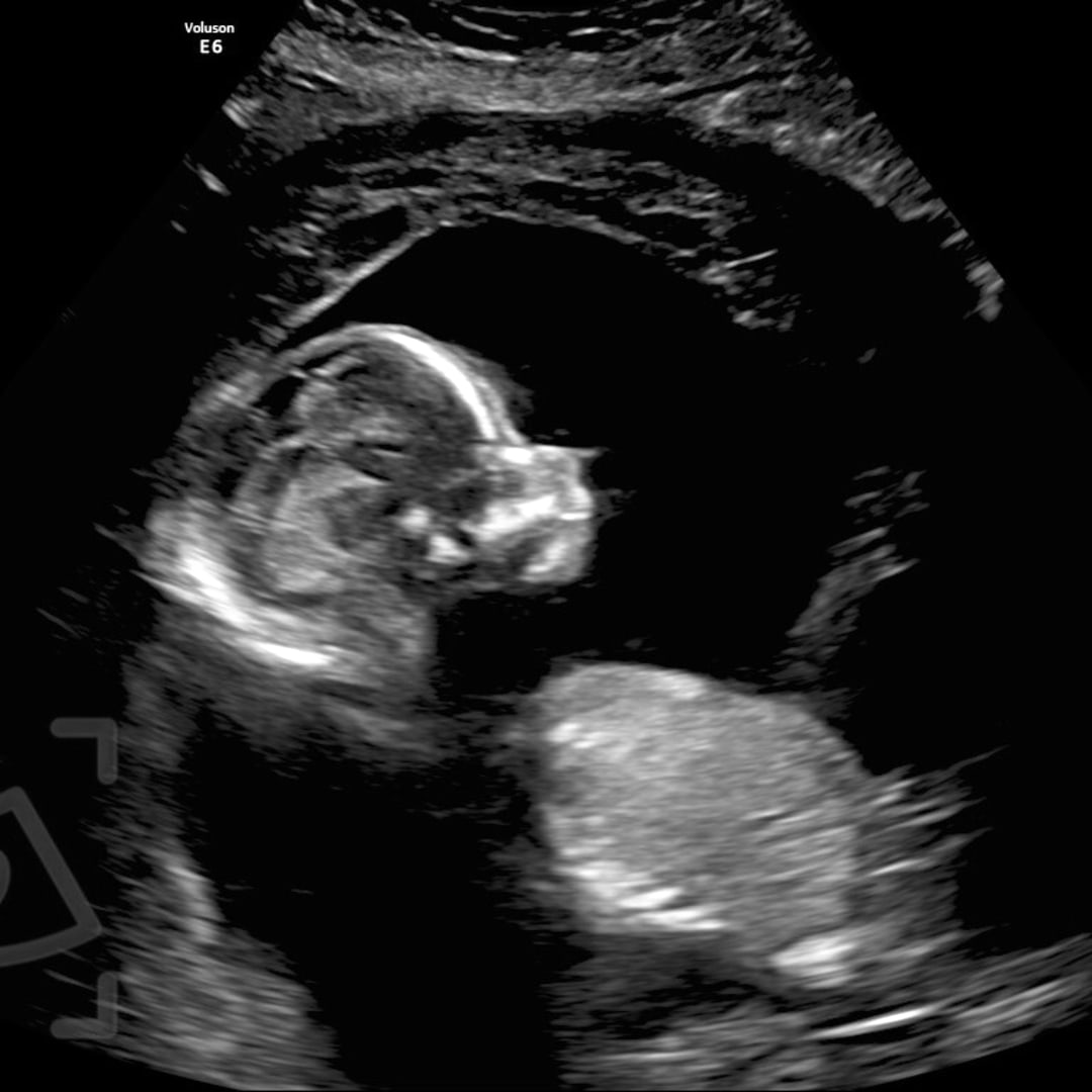 Photo shared by Cooper & Abby for their Babylist baby registry.