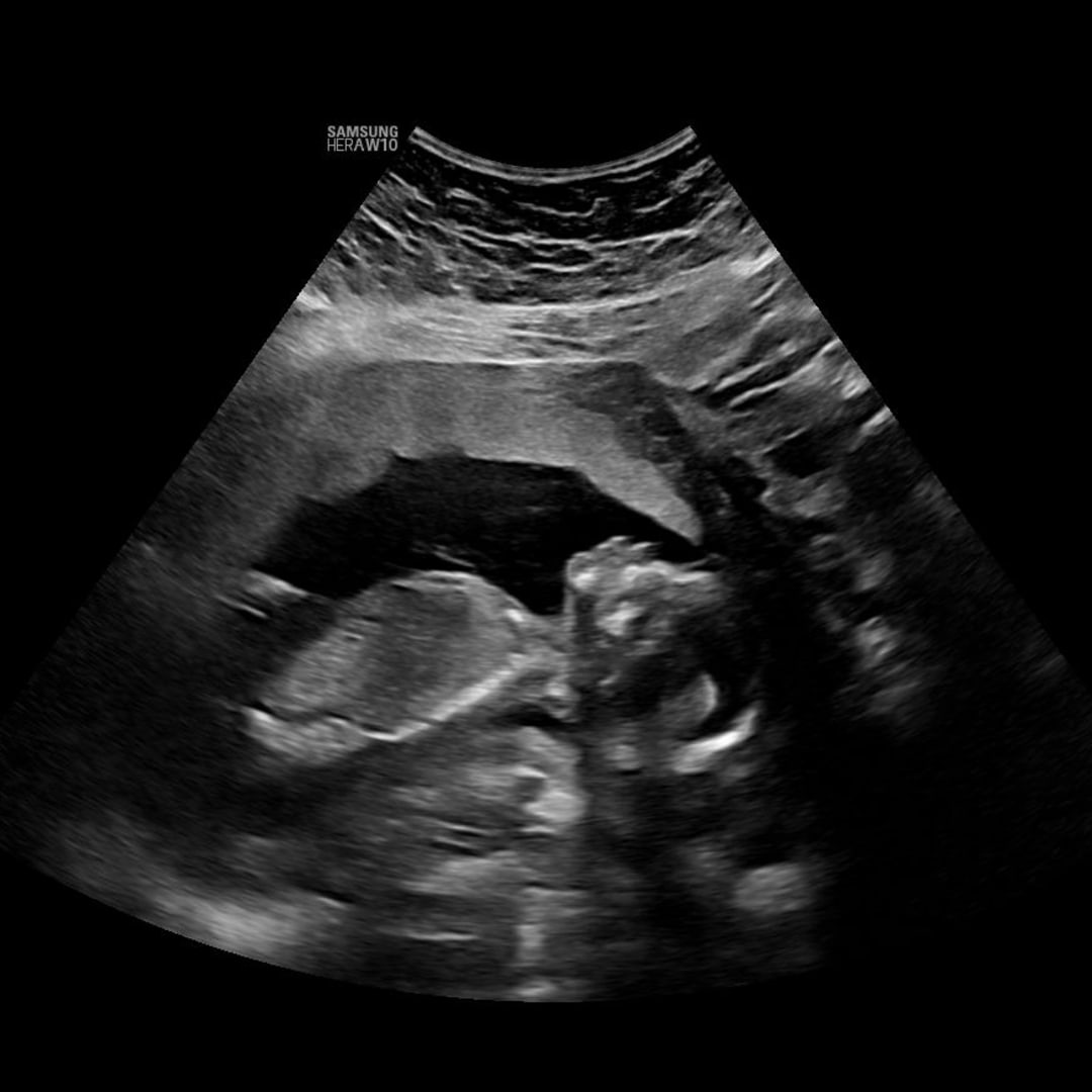 Photo shared by Liz for their Babylist baby registry.