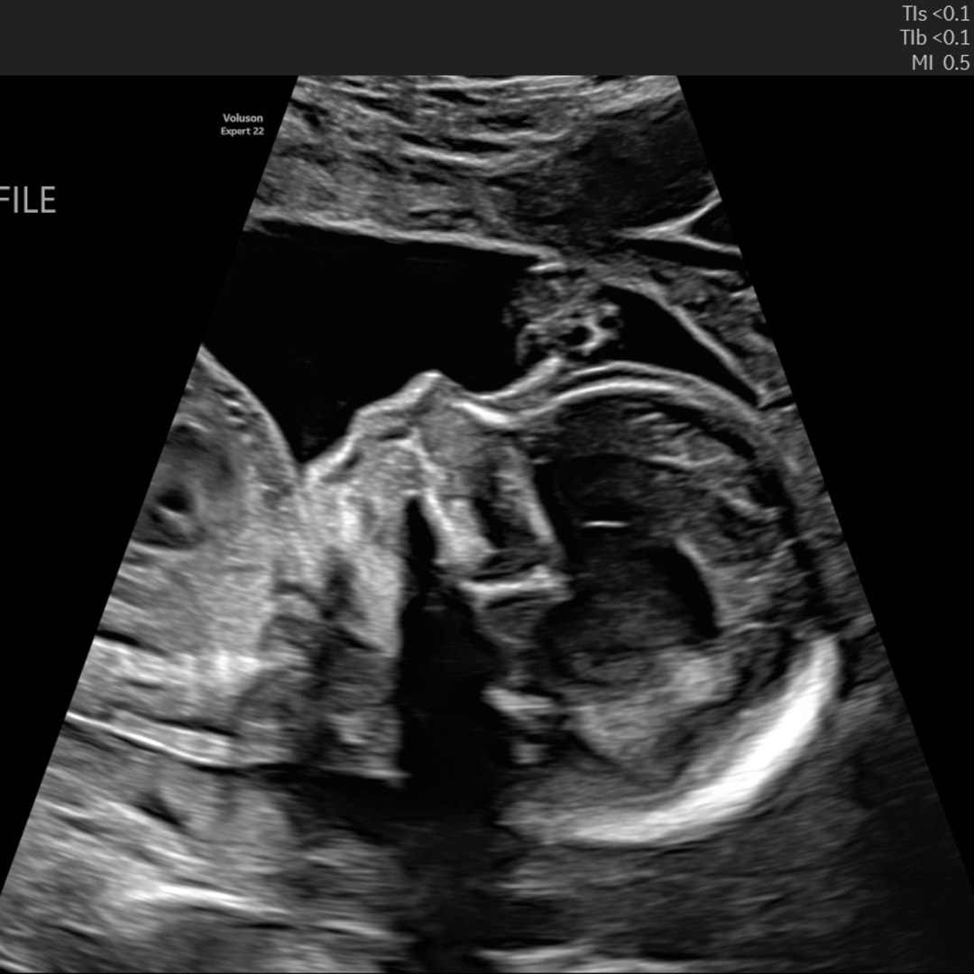 Photo shared by Deidra for their Babylist baby registry.