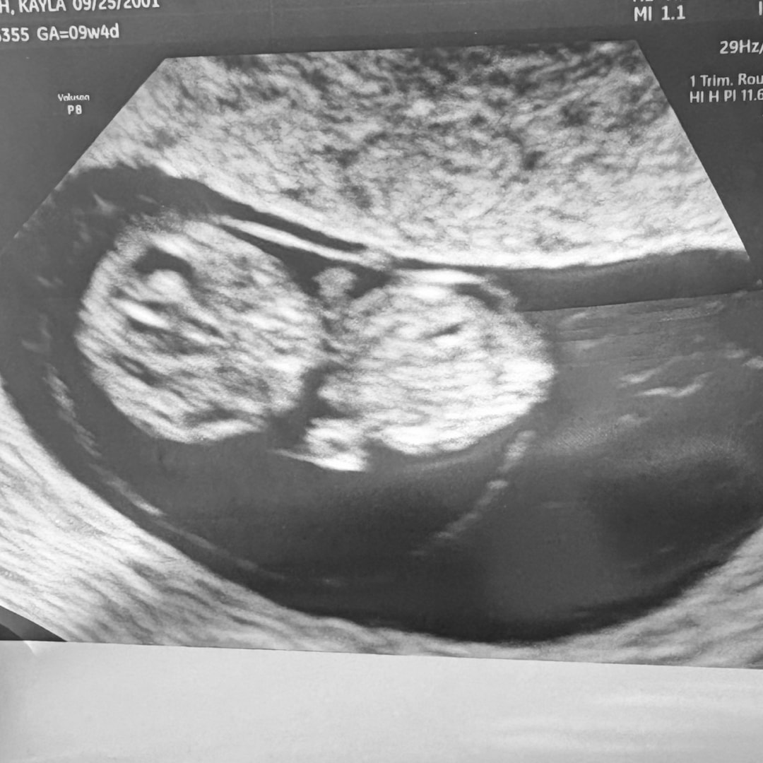 Photo shared by Kayla for their Babylist baby registry.