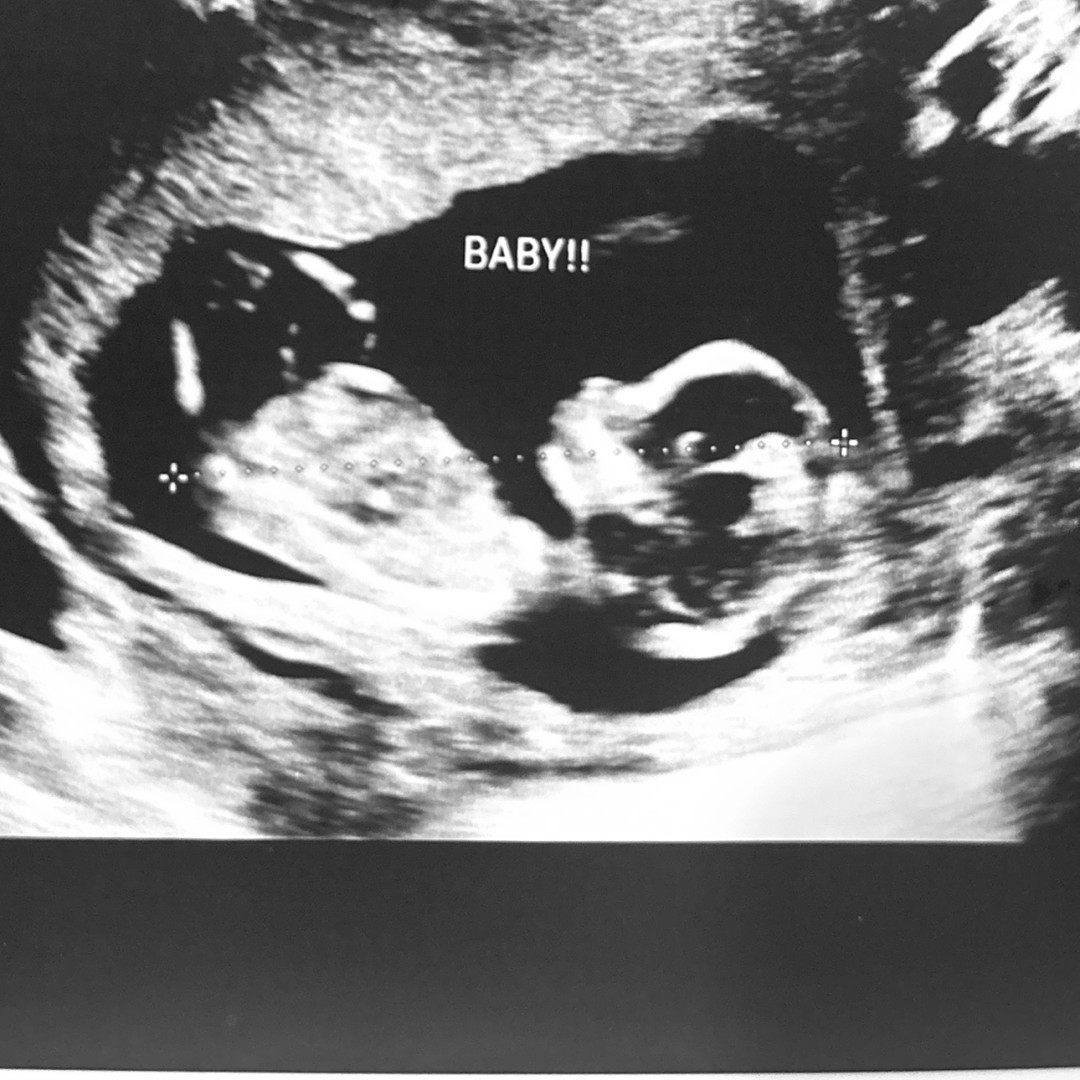 Photo shared by Jaslyn for their Babylist baby registry.