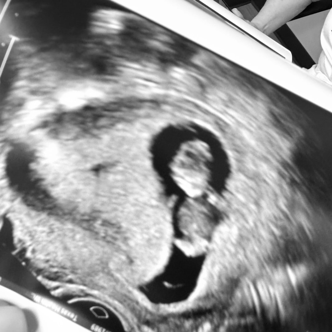 Photo shared by Angel for their Babylist baby registry.