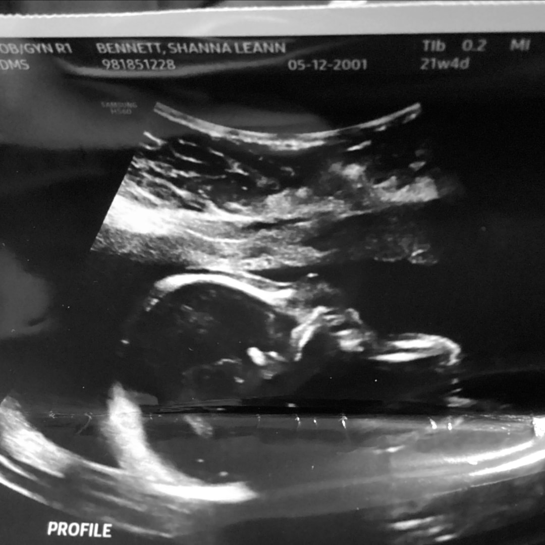 Photo shared by Shanna for their Babylist baby registry.