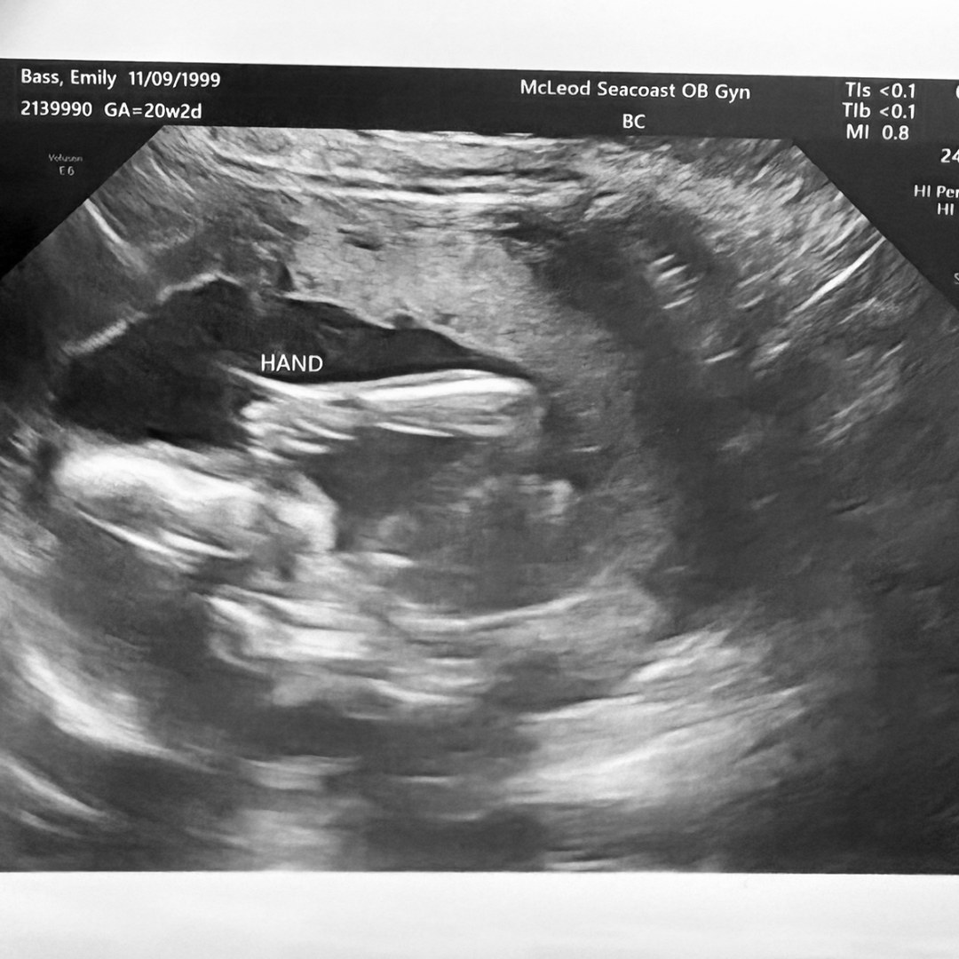 Photo shared by Emily for their Babylist baby registry.