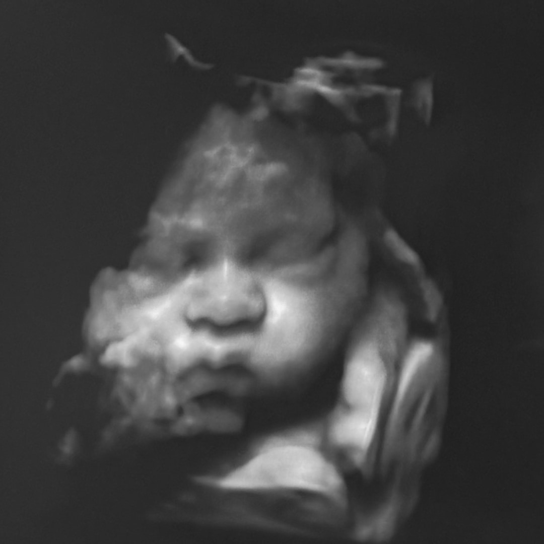 Photo shared by Evelyn for their Babylist baby registry.