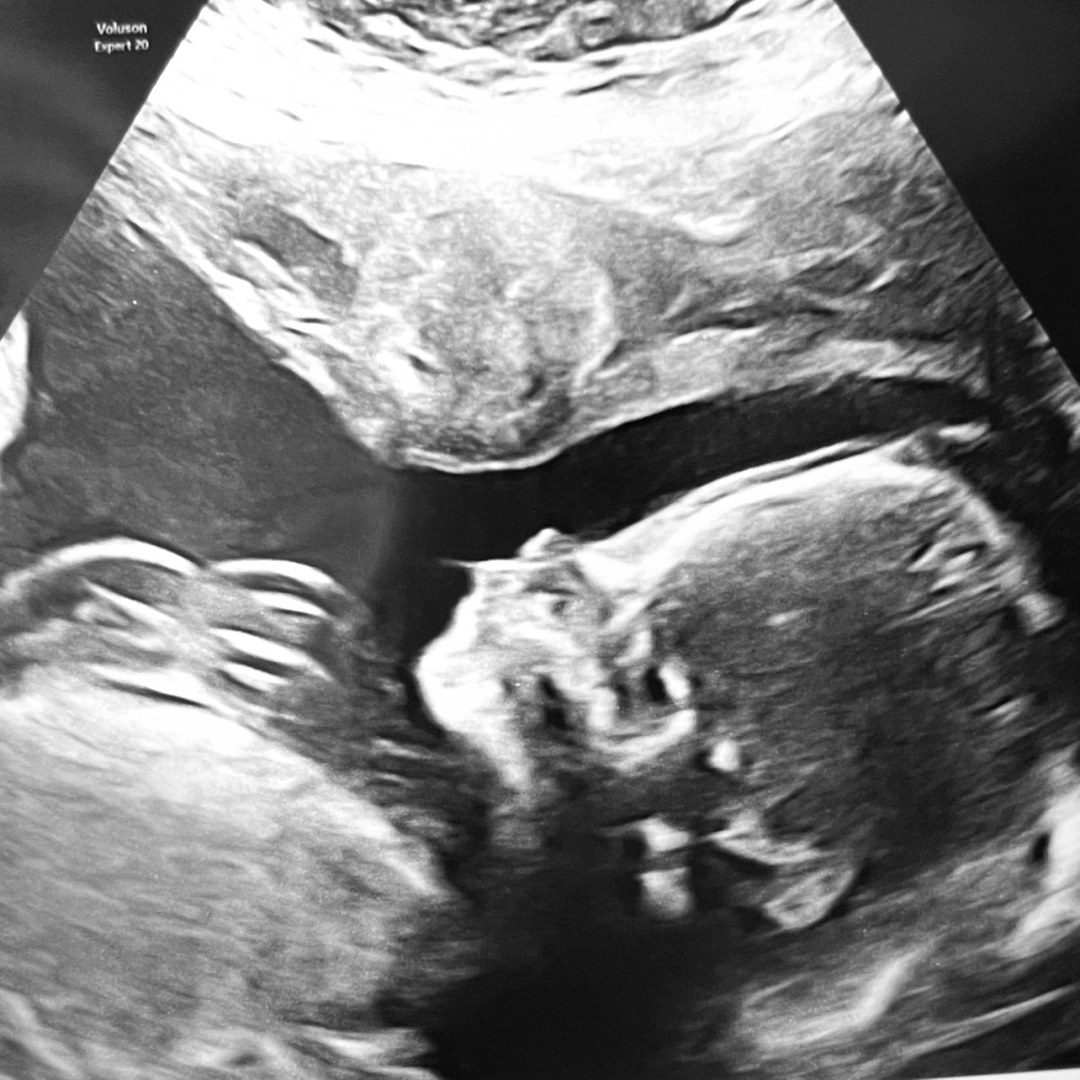 Photo shared by Cristal for their Babylist baby registry.