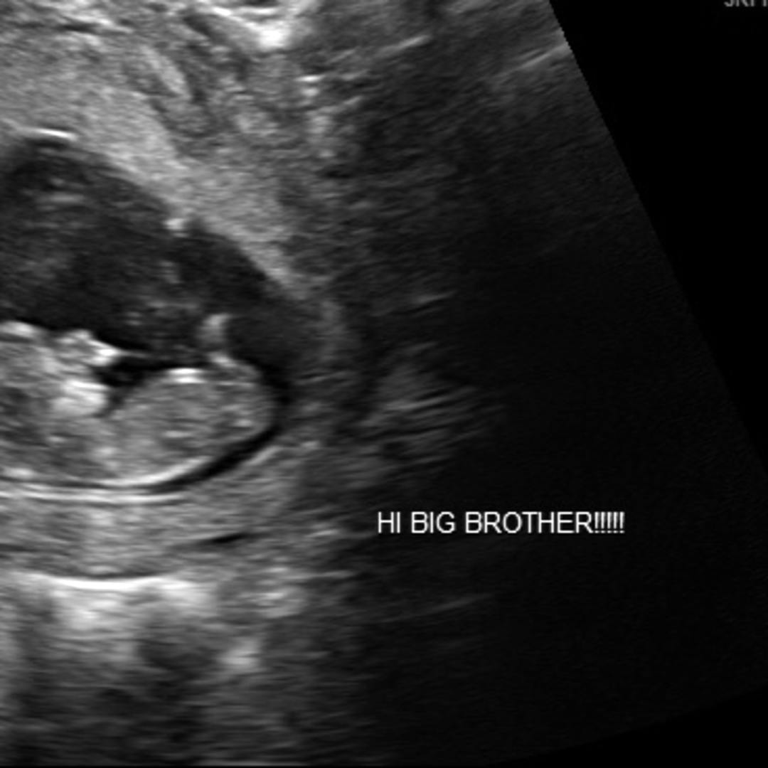 Photo shared by Skie for their Babylist baby registry.