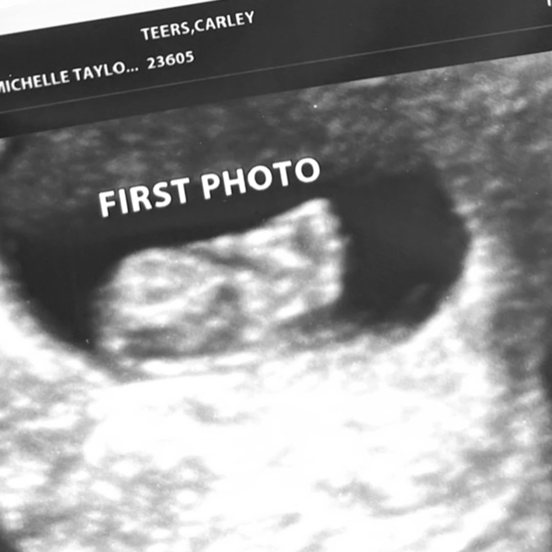 Photo shared by Carley for their Babylist baby registry.