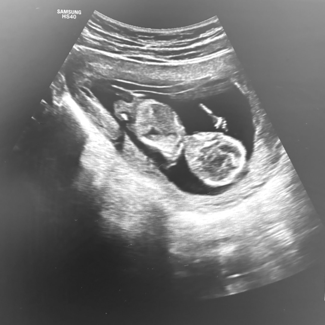 Photo shared by Alexis for their Babylist baby registry.