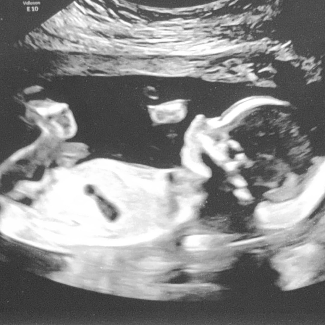 Photo shared by Bianca for their Babylist baby registry.