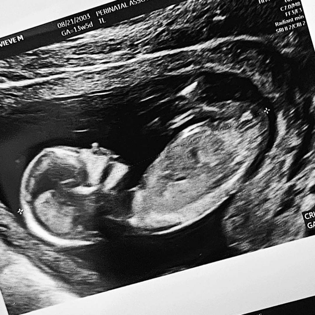 Photo shared by Genevieve for their Babylist baby registry.