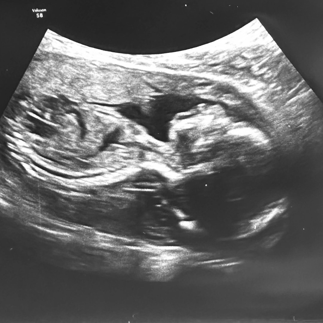 Photo shared by Hannah for their Babylist baby registry.