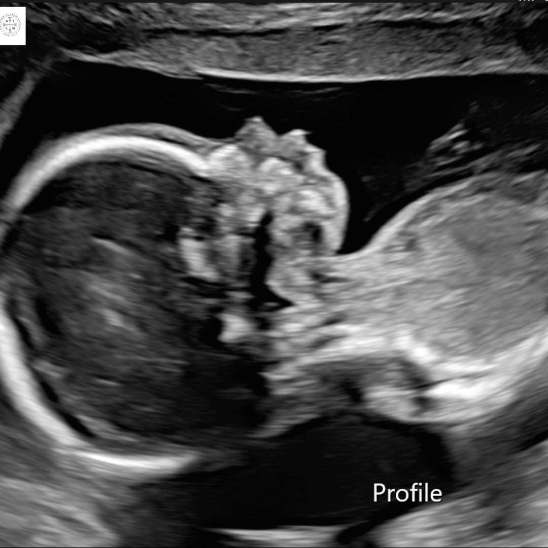Photo shared by Larlei for their Babylist baby registry.