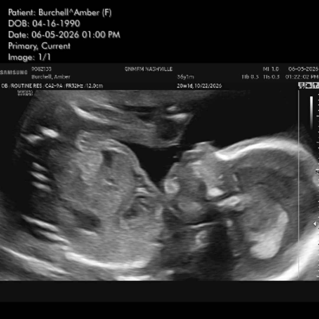 Photo shared by Amber for their Babylist baby registry.