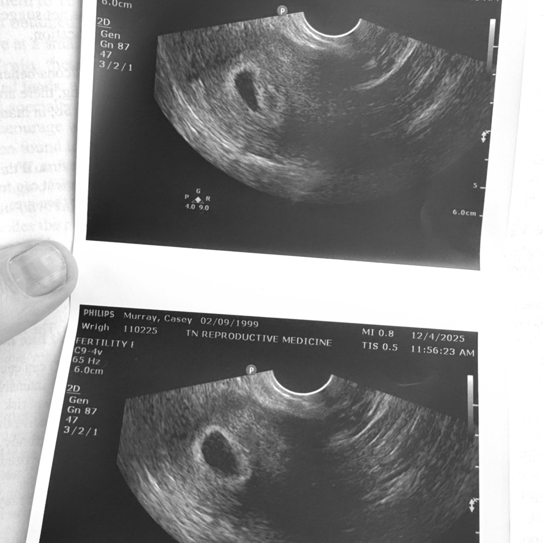 Photo shared by Casey for their Babylist baby registry.