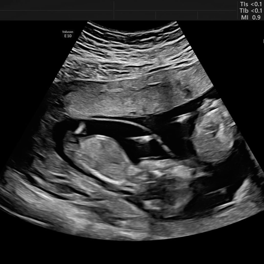 Photo shared by Gifany Ten-Ten for their Babylist baby registry.