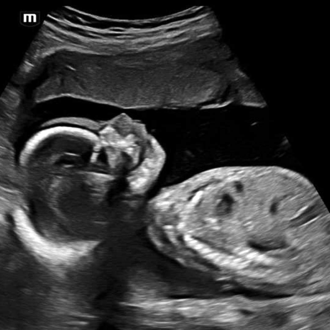 Photo shared by Ella for their Babylist baby registry.