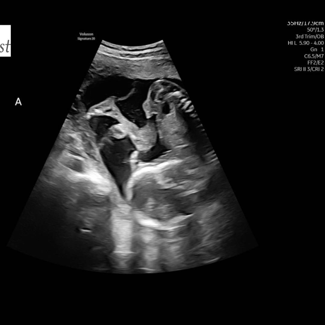 Photo shared by Keely for their Babylist baby registry.