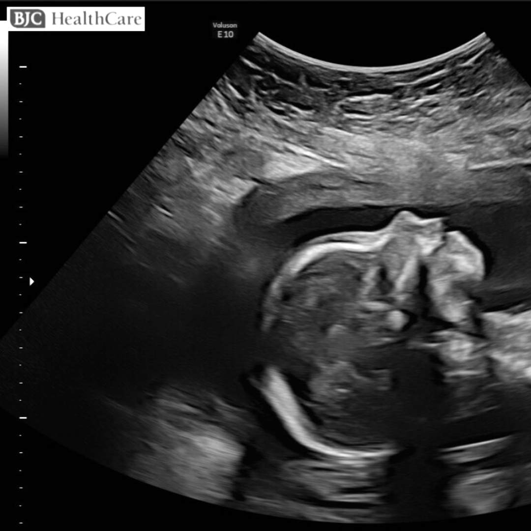 Photo shared by Megan for their Babylist baby registry.